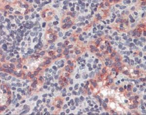 Anti-NOS3 Mouse Monoclonal Antibody
