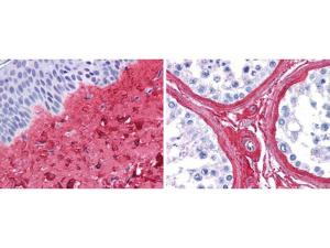 Anti-COL3A1 Rabbit Polyclonal Antibody