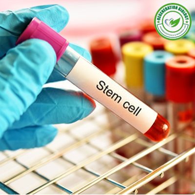 RFP-Human Induced Pluripotent Stem (IPS) Cells