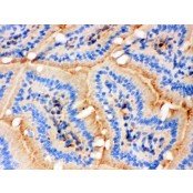 Anti-Actin Antibody (Monoclonal, AC-40)