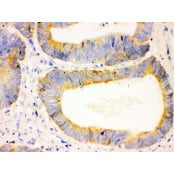 Anti-Bcl-2 Antibody (Monoclonal, Bcl-2-100) CA1004